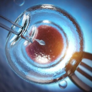 IVF at Beilinson Clinic