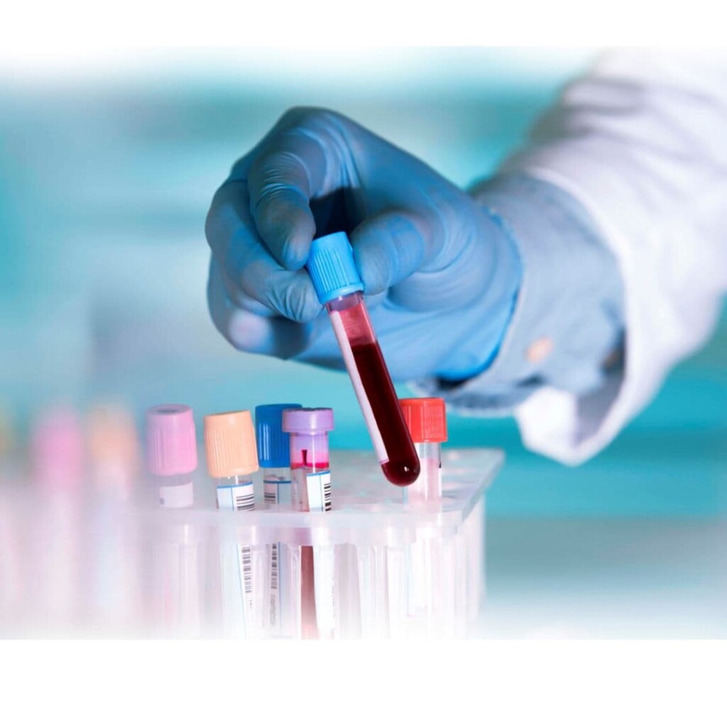 Laber Genys CeGaT Genetic Laboratory
