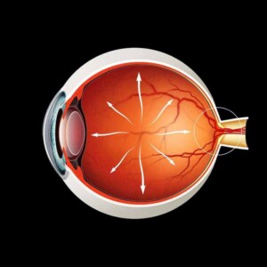 Лечение глаукомы в Батигоз