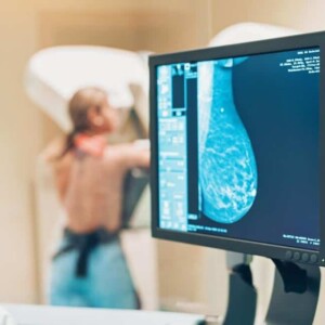 тривимірна мамографія