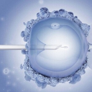 In vitro fertilization at Sheba Hospital