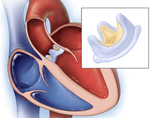 biological heart valve