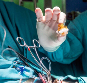 операція із заміни клапана серця в Туреччині