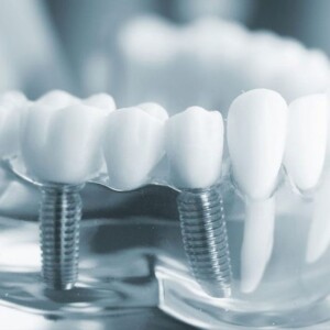 Prices for dental services in Esteworld