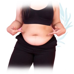 bariatric surgery for body mass index above 30