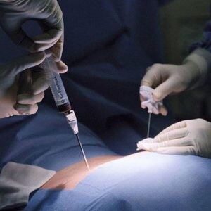 Как проводится аутологичная пересадка костного мозга в клиниках Турции