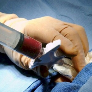 пересадка кісткового мозку