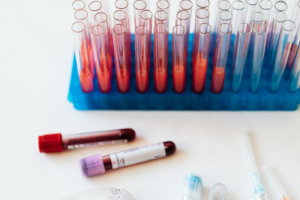 What cancer tests can be done if cancer is suspected