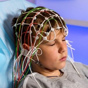 Treatment of pediatric epilepsy in Israel