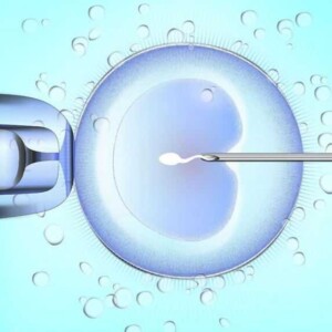 How IVF is carried out abroad