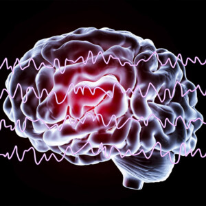 Лечение эпилепсии за границей: стимуляция мозга 