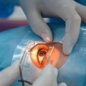 surgical treatment of glaucoma in Turkey