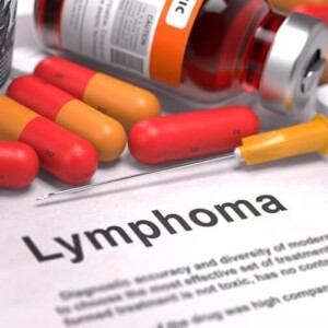 Cost of Lymphoma Treatment