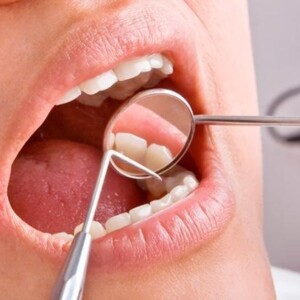 Диагностика перед протезированием зубов в Турции: Осмотр полости рта