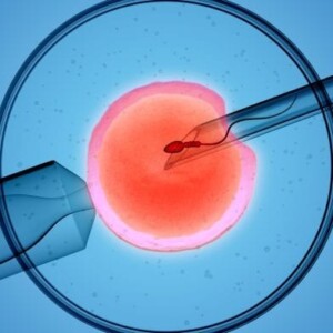 Анталиядағы IVF: процедура әдістері