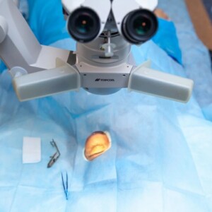 Клиники лучшие для лечения катаракты в Израиле