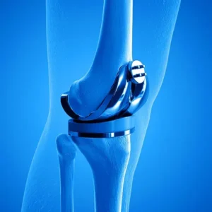 Treatment of the knee joint in Germany
