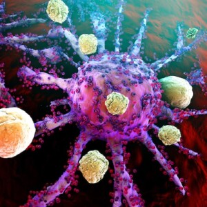 иммунотерапия при раке легких в Израиле