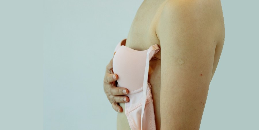 Plastic surgery after breast removal