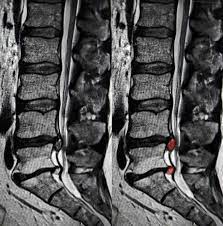 диагностика при лечении спины в Израиле