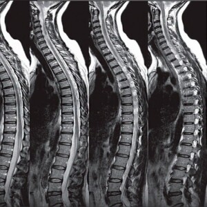 Spine diagnostics in Germany