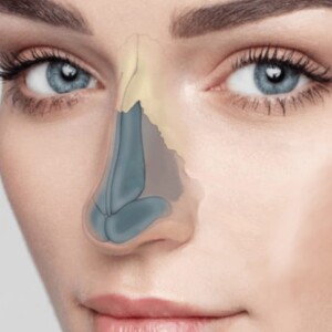 методы пластики носа в Корее