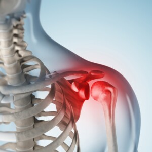 Treatment of the shoulder joint in Germany