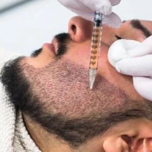 выбор клиники и врача для пересадки бороды в Турции