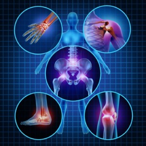 Treatment of joints in Germany