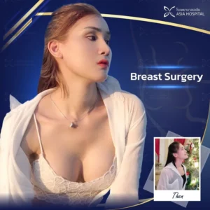 плстические операции в Таиланде