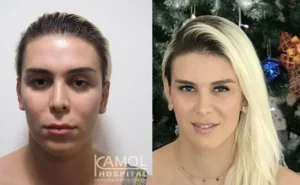 смена пола в Таиланде