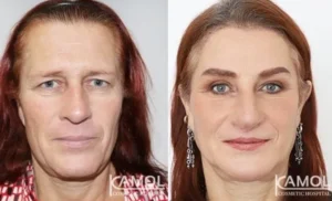 феминизация лица в Таиланде