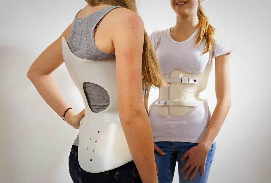 What should a corset for scoliosis correction be like?