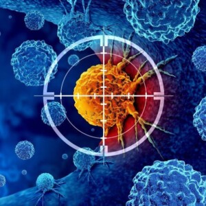 Таргетна та імунна терапії при лікуванні раку шлунка в Німеччині