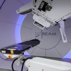 proton therapy for tongue cancer