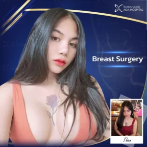 маммопластика Таиланде
