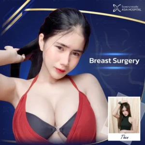 увеличение груди в Таиланде