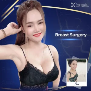 пластический хирург в Таиланде