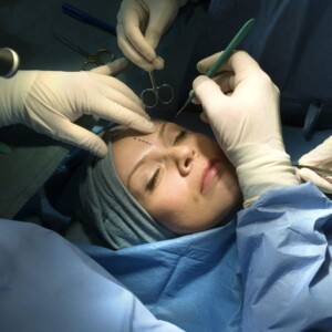 Plastic surgeons in Turkey