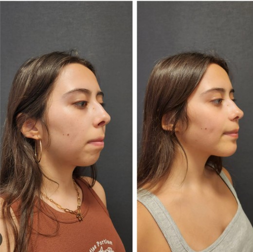 Когда операция действительно нужна?