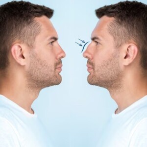 Precio de la rinoplastia en Turquía