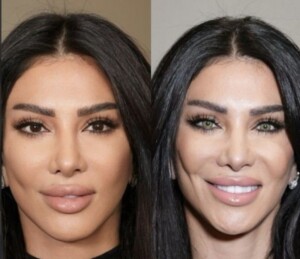 cambio de color de los ojos