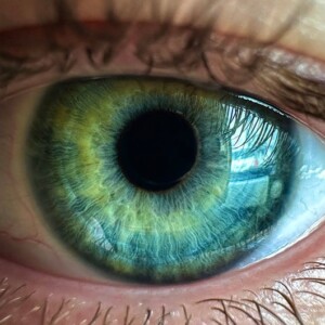 queratopigmentación antes y después