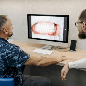 ¿Qué carillas son las mejores?