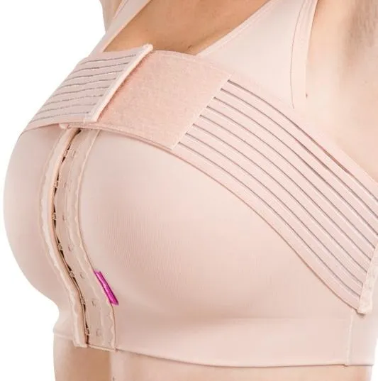 Lo que necesitas saber sobre las cicatrices postoperatorias y cómo se relaciona con el tipo de cirugía