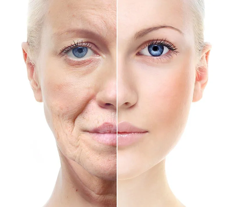 Как долго сохраняется эффект?