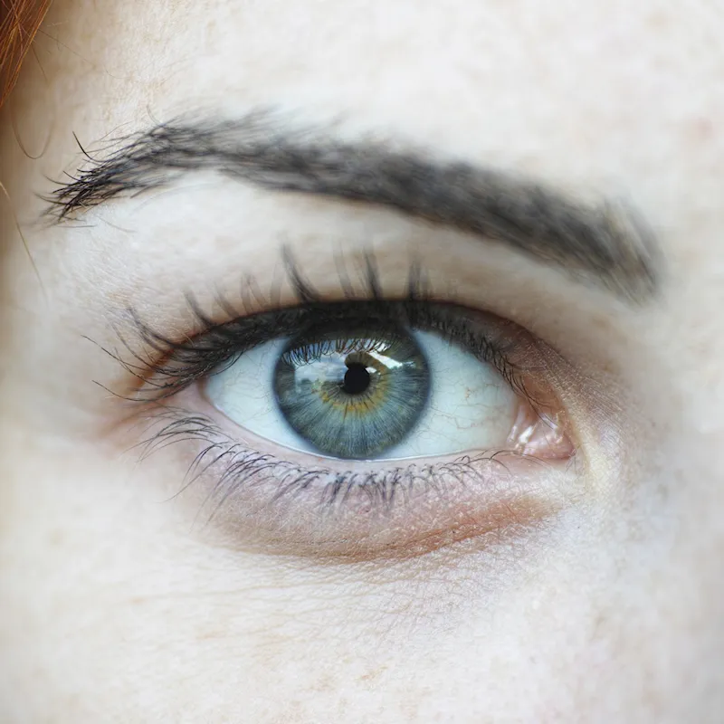 Установка клапана Ахмеда в Турции для лечения глаукомы