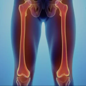 Удлинение конечностей