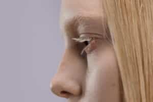 Top Revision Rhinoplasty Surgeons in Turkey