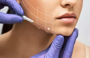 Non-Surgical Mini Facelift